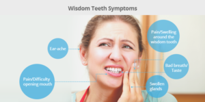 Wisdom Teeth: Every Information We Need To Know – Hitbrother